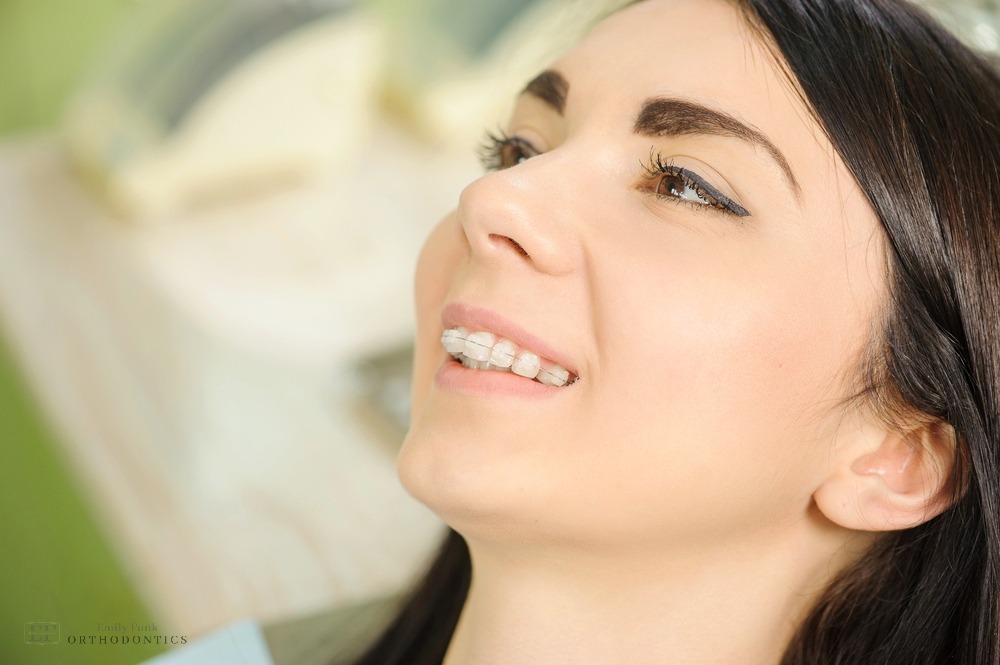 Close-up of a relaxed woman in a dental chair during her braces for overbite in chester springs, pa treatment.