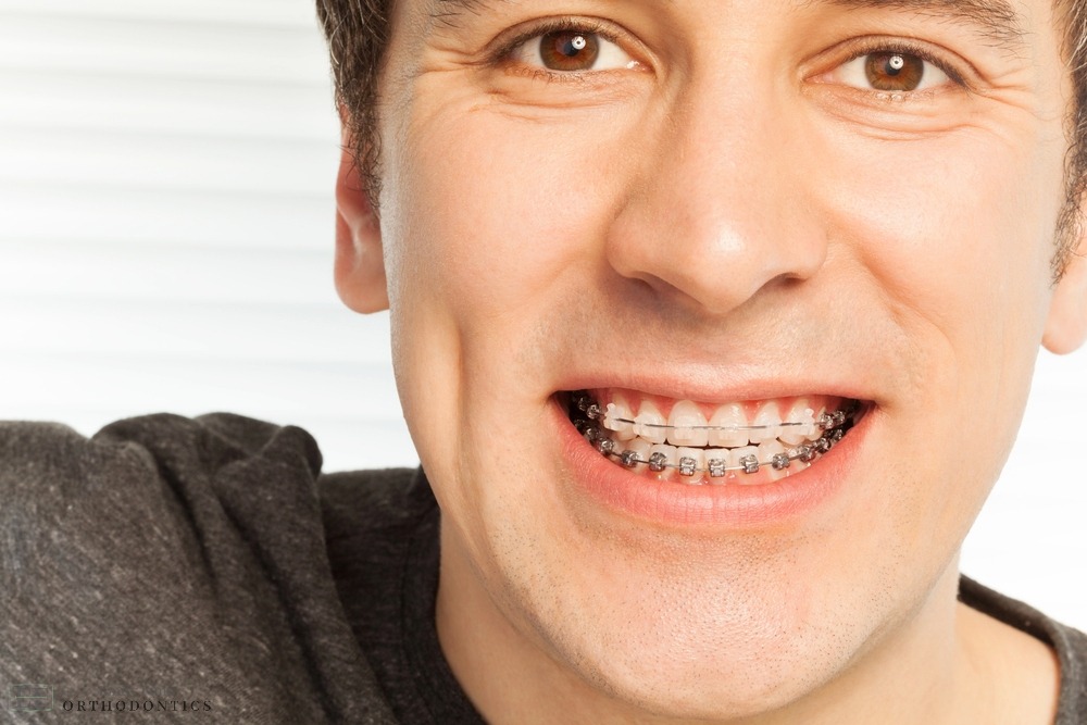 happy young man with metal braces - Overbite vs Underbite in Chester Springs, PA.