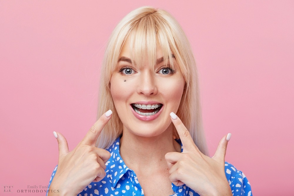 cheerful happy young woman blonde hair gesturing thumb while pointing clear braces - Clear Braces vs Metal Braces in Chester Springs, PA